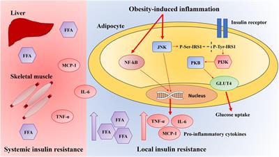 Chronic Adipose Tissue Inflammation Linking Obesity to Insulin Resistance and Type 2 Diabetes